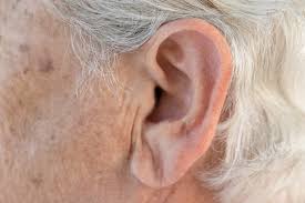 In the united states, it's estimated that doctors diagnose over 100,000 new skin cancer cases each year. Best Earlobe Wrinkles Phoenix Scottsdale Phoenix Skin