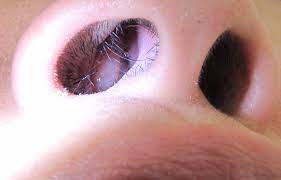 Hidung peka terhadap aroma karena terdiri dari beberapa struktur. Polip Hidung Wikipedia Bahasa Indonesia Ensiklopedia Bebas