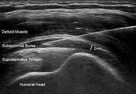 Image result for Shoulder Imaging
