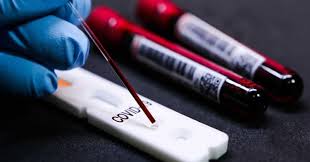 Em julho, a segunda dose será aplicada em quem recebeu as vacinas astrazeneca, no mês de abril, e. Vacina Da Covid 19 Sao Paulo E Distrito Federal Vao Ampliar Calendario