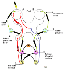 Image result for Pupillary Paralysis