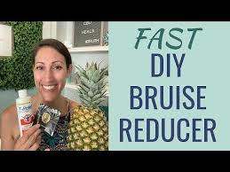 Jul 01, 2021 · you can get rid of bruises by icing the area as soon as possible after the injury. How To Get A Bruise Zonealarm Results