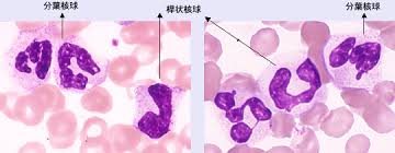 ネットで形態 血液形態自習塾 第2部 末梢血 骨髄像の見方 考え方 ベックマン コールター