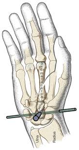 Image result for Capitate Bone