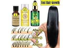 Moroccan oil around rs 3000 but i can use it for a solid 2 years. Say Goodbye To Hair Loss Chinese Herbal Fast Hair Growth Essential Oil Recommend 1 2 3 Wish