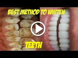 Mix hydrogen peroxide and baking soda to make a thick mixture. Brown Stains On Teeth Removal Teethwalls