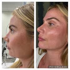 ReNu Self Medical (@renuselfmedical) • Instagram photos and videos