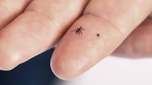 Image result for infected tick bite
