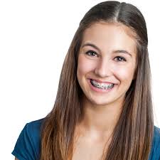 There are a lot of different uses for braces, because every mouth and set of teeth are totally unique. How Do I Know If My Braces Are Working Akavan Orthodontics