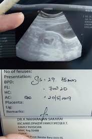 Banyak loh nama bayi dari bahasa arab yang mempunyai arti yang bagus dan juga mudah untuk diucapkan. Gambar Scan Bayi Lelaki Dalam Kandungan Wanita Cantik Buat Quotes