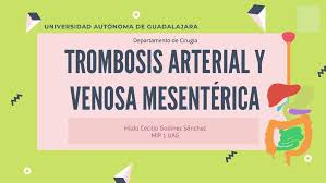 Las causas principales de la trombosis son la sangre. Trombosis Arterial Y Venosa Mesenterica Gastroenterologia Resumenes De Medicina Udocz