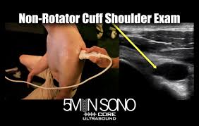 Image result for Shoulder Exam