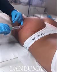 Body Contouring