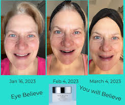 What is the best eye cream for wrinkles until I can get Botox?