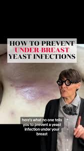 Image result for Candidiasis under breasts