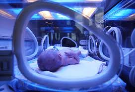 Top 10 Home Remedies For Jaundice In Newborn Baby
