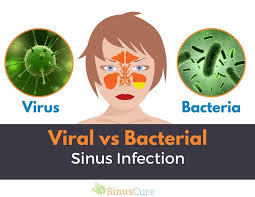 Viral Or Bacterial Sinus Infection What The Difference Sinusitis Sinus Infection Pregnant Sinus Infection Relief