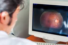 Anthony rossi has been wonderful in providing our family with glasses. Texas State Optical Westwood Eye Doctors Eye Exams Call Now