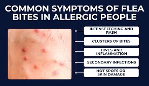 Image result for flea bites