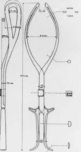 This view could easily represent the forceps as applied to a right occiput transverse position with asynclitism. Dr Christian Kielland Of Oslo 1871 1941 And His Straight Forceps Adc Fetal Neonatal Edition