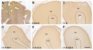 Therapeutic Hypothermia Attenuates Cortical Interneuron Loss after Cerebral  Ischemia in Near-Term Fetal Sheep