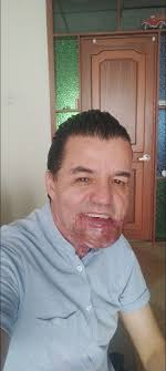 Nelson Garzon Vivir Es Vencer.