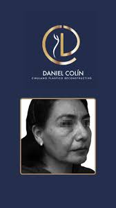 Daniel Colin Cirujano