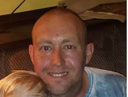 This is the horrifying reality of what happens when laser tattoo removal  'goes wrong'