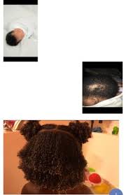 Skin Tone And Hair Texture Babycenter