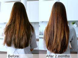 We did not find results for: Oferta Hairjazz Pelo Crecimiento Juego Champu Hialuronico Suavizante Locion Ebay