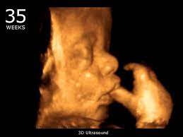Baby impressions is an elective 3d 4d ultrasound imaging facility. 35 Week Pregnancy Ultrasound Pregnancywalls