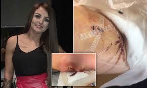 She got the nexplanon and was constantly having super heavy and long periods with only like maybe a few days in between so her doctor and her decided to have it removed. Nhs Botched Up A Removal Of The Contraceptive Implant Daily Mail Online