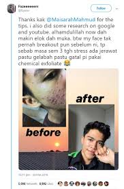 Gunakan pembersih muka daripada cecair daripada jenis bar. Dari Muka Berjerawat Teruk Lelaki Kongsi Cara Dia Pulihkan Wajah Dengan Produk Ini Maskulin