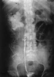 Image result for Fuirena abnormalis