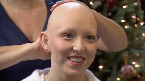 Woman with alopecia 'wouldn't change' her identity