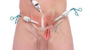 Image result for Inguinal hernia man