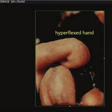 Check spelling or type a new query. Radu Vladareanu S Research Works Carol Davila University Of Medicine And Pharmacy Bucharest Umf Cd And Other Places