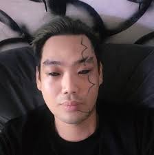 Something a little different. Three months healed.