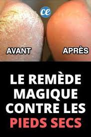 Pieds Secs Le Remede Magique Pour Avoir Des Pieds Tout Doux Recette En 2020 Pied Sec Soins De La Peau Naturels Produits De Beaute Faits Maison