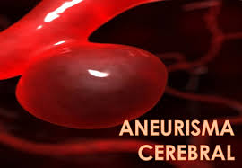 Sin embargo, la mayoría de los aneurismas cerebrales no presentan roturas, no crean problemas de salud y no causan síntomas. Team Phoenix Aneurisma Cerebral Brain Aneurysm