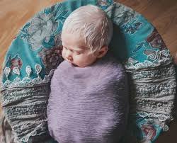 Collection by brenda r mcpherson. Our Baby Had A Head Full Of Hair White As Snow Mom S Shocked Reaction To Albino Newborn Blonde Baby Boy Baby Girl Born Beautiful Baby Girl