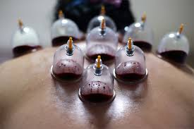 Cupping Therapy Detoxification