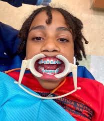 TenBrook Orthodontics (@tenbrookortho) • Fotografije in videoposnetki v  Instagramu