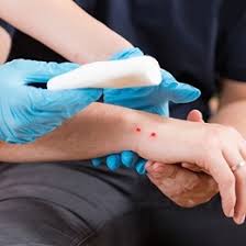 Yilan Sokmasi Ilk Yardim Yilan Isirmasi Belirtileri Tedavisi Medicana Saglik Grubu