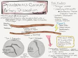 Spontaneous Coronary Artery Dissection Coronary Artery Disease Nursing Coronary Arteries Arteries