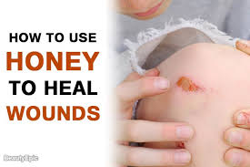 Honey For Wounds Wounds Healing Health Magazine