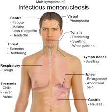 Glandular Fever