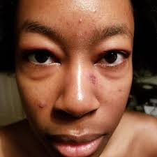 UMass Chan Medical School