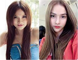 Tp.hcm dịch covid bùng phát, người gò vấp những ngày phong tỏa: Kin Nguyá»…n Thu Thuá»· Co TÆ°á»›ng Phu The Do Pháº«u Thuáº­t Tháº©m Má»¹