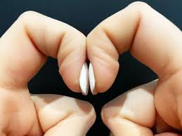 Pet scans can't see nodules less than about a centimeter, but can be helpful for larger nodules, both to tell if the nodule is cancer and also to see if there are any signs of cancer in other parts of your body. Finger Clubbing The Sign That Could Warn You Of Lung Cancer Huffpost Uk Life